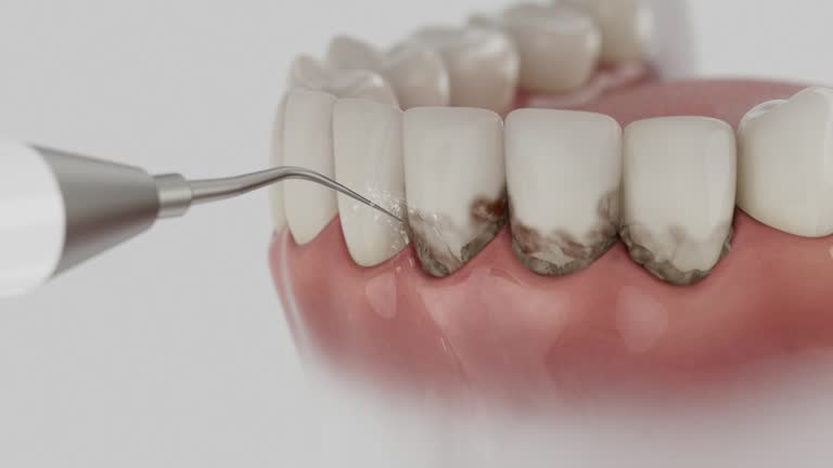Reliable Dental contractor in Bruce, MS by Smile Center Dentistry